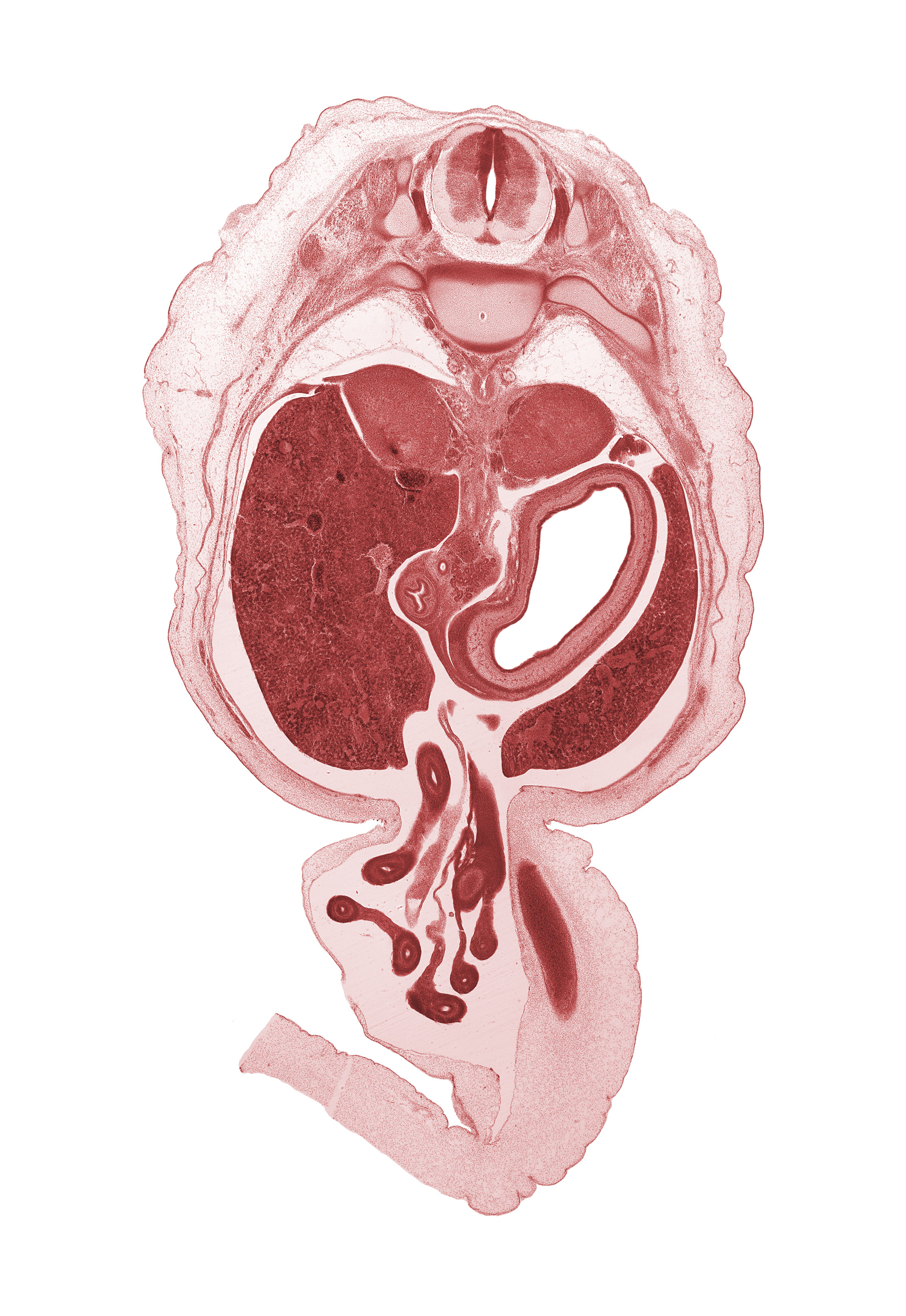 T-10 / T-11 intervertebral disc, T-11 spinal ganglion, aorta, bile duct, centrum of T-11 vertebra, descending part of duodenum (second part), distal limb of herniated midgut, head of rib 11, jejunum, left lobe of liver, lumen of body of stomach, mesentery, notochord, proximal limb of herniated midgut, superior mesenteric artery, testis, umbilical vein