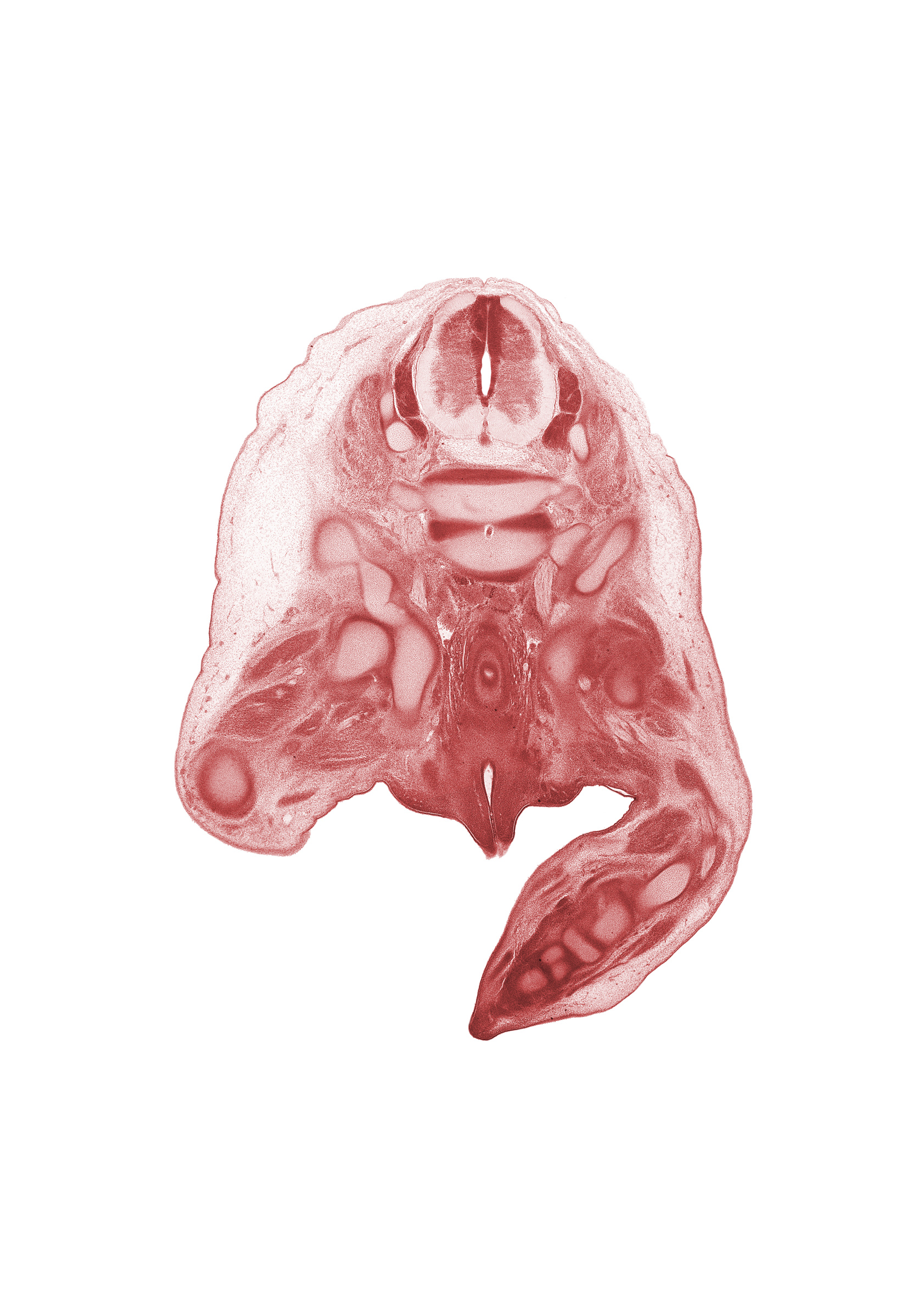 L-4 / L-5 intervertebral disc, L-4 spinal ganglion, L-5 / S-1 intervertebral disc, L-5 spinal ganglion, L-5 spinal nerve, S-1 spinal nerve, ala of sacrum, caudal edge of peritoneal cavity, centrum of S-1 vertebra (cephalic edge of sacrum), fibula, ilium, internal iliac vein, ischiorectal fossa, ischium, rectum, sciatic nerve, scrotal swelling, tarsal cartilage(s), urethra, urethral fold