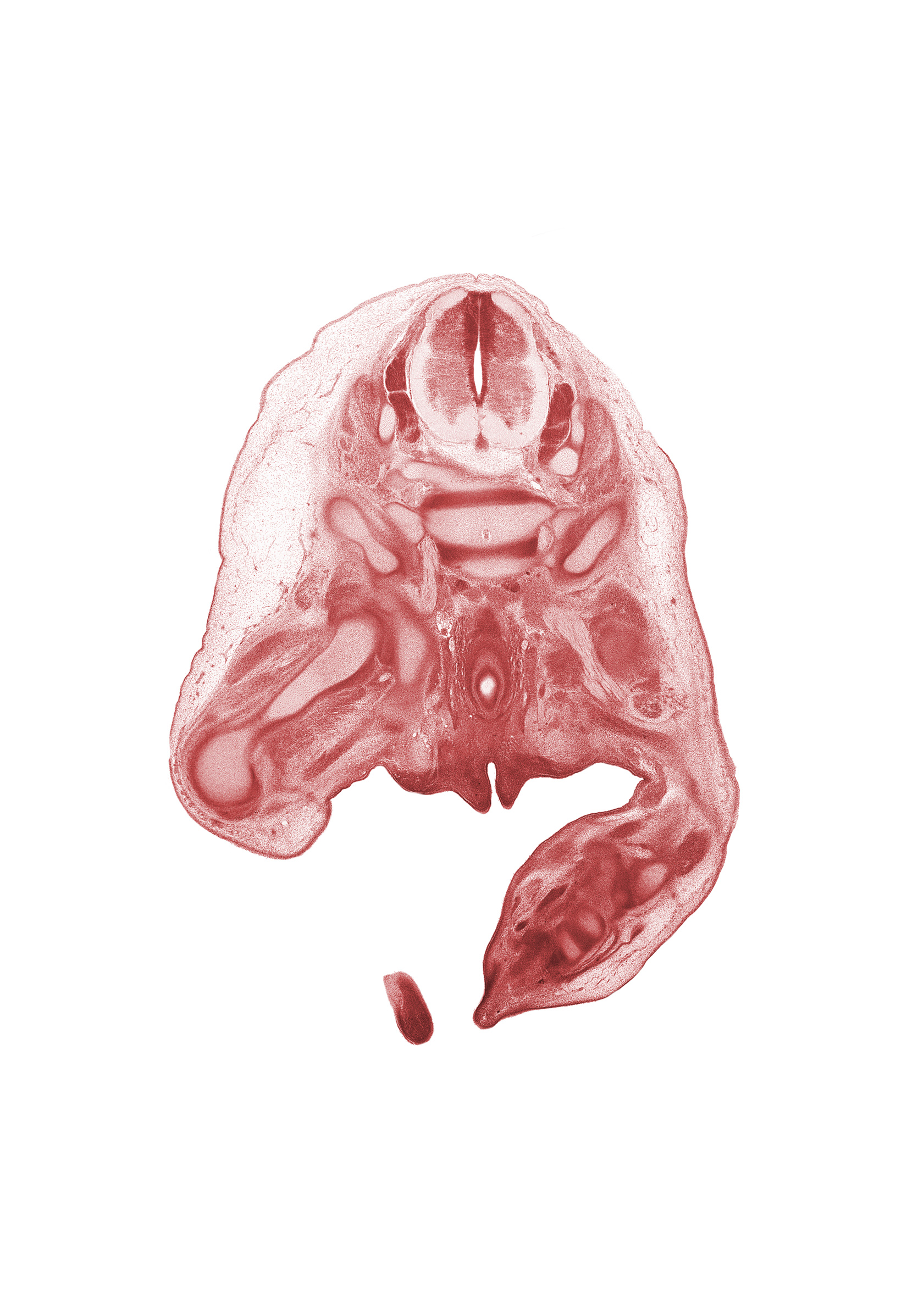 L-5 / S-1 intervertebral disc, L-5 spinal ganglion, L-5 spinal nerve, L-5 ventral root, S-1 / S-2 interganglion region, S-1 spinal ganglion, S-1 spinal nerve, blastemata of gluteal muscles, fibula, hip joint, ilium, rectum, scrotal swelling, urethral fold, urethral groove