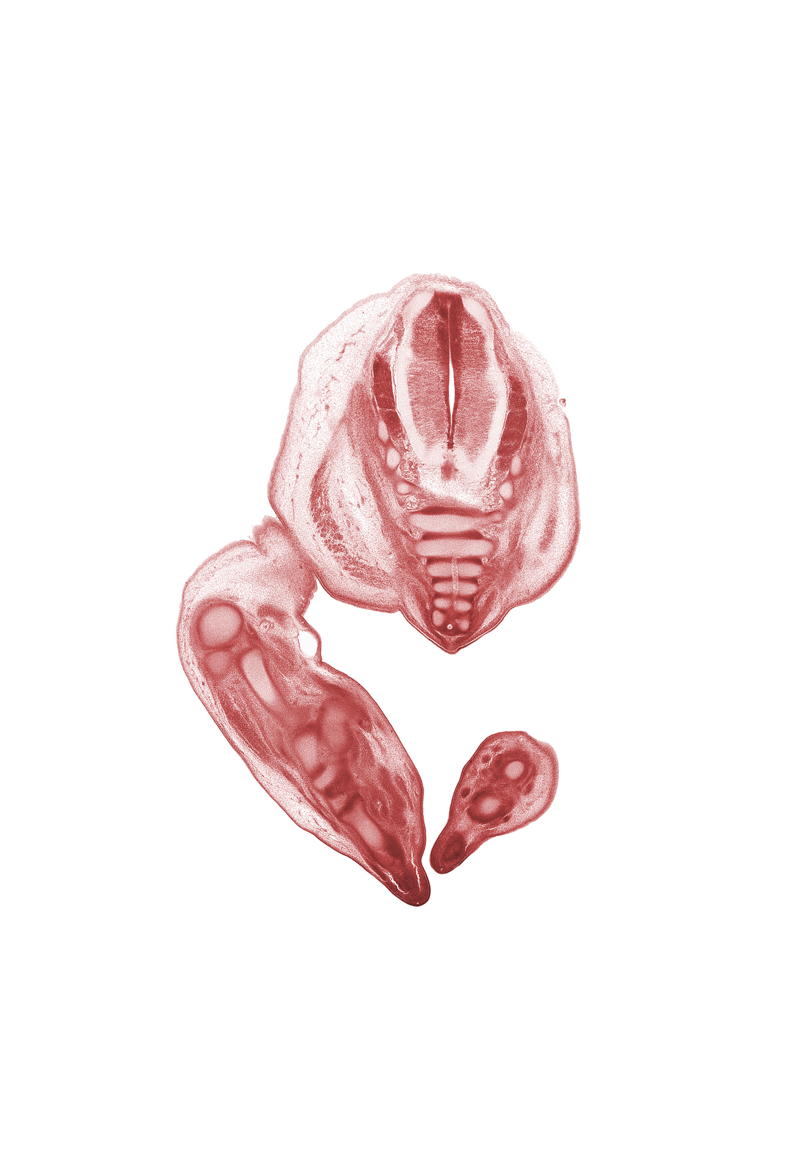 Co-1 / Co-2 intervertebral region, Co-1 spinal nerve, Co-2 / Co-3 intervertebral region, S-2 dorsal root, S-2 spinal ganglion, S-3 / S-4 intervertebral region, S-3 spinal ganglion, S-3 spinal nerve, S-4 / S-5 intervertebral region, S-4 spinal ganglion, S-4 spinal nerve, S-5 / Co-1 intervertebral region, S-5 spinal nerve, blastema of proximal phalynx (foot), coccyx, fibula, metatarsal cartilage, notochord, tarsal cartilage(s)