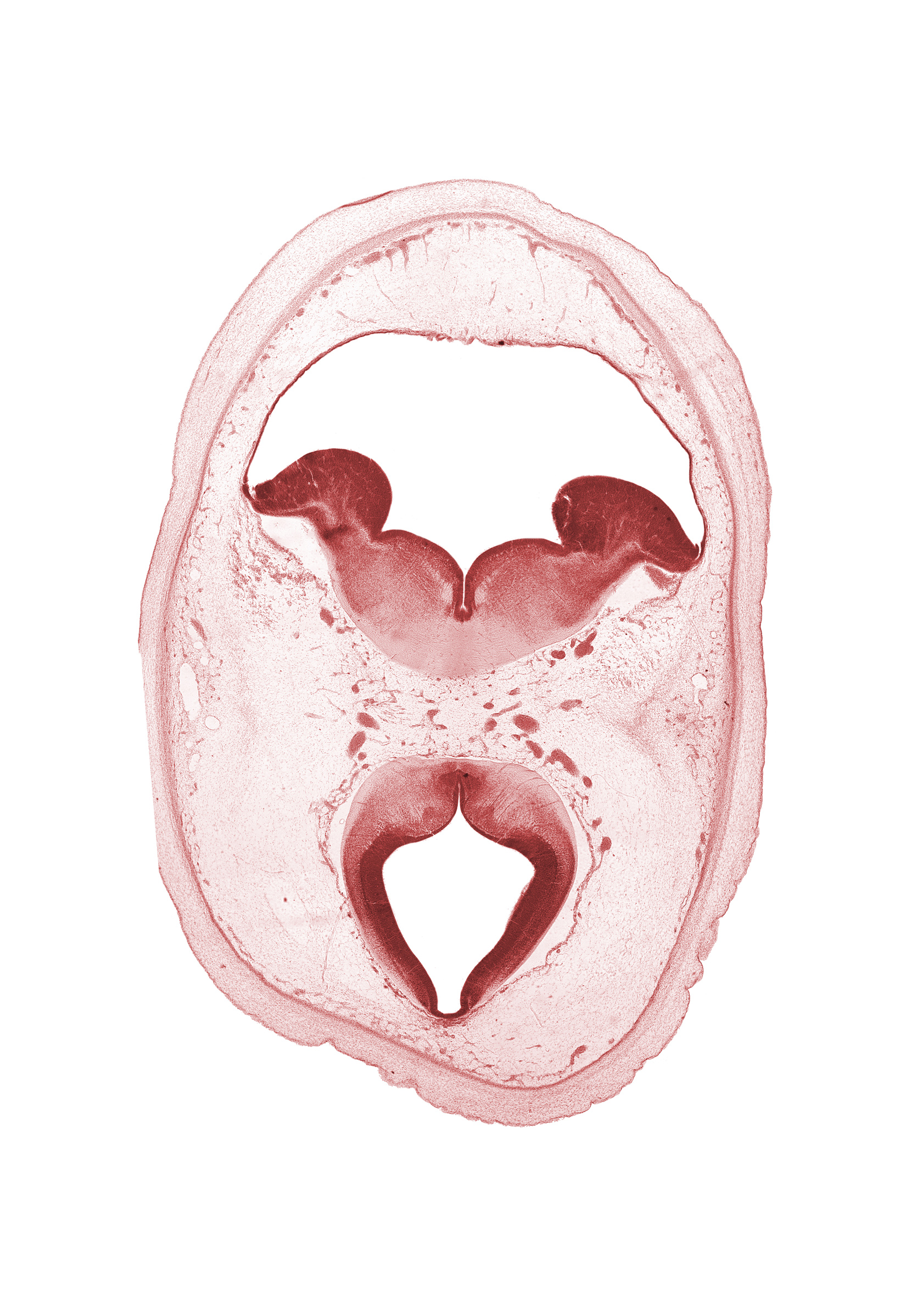 artifact separation(s), external cerebellum, internal cerebellum, median sulcus, mesencephalon, oculomotor nerve (CN III), pons region (metencephalon), rhombencoel (fourth ventricle), roof of rhombencoel (fourth ventricle), roof plate of mesencephalon, subarachnoid space, sulcus limitans, tectum, tegmentum, trochlear nerve (CN IV)