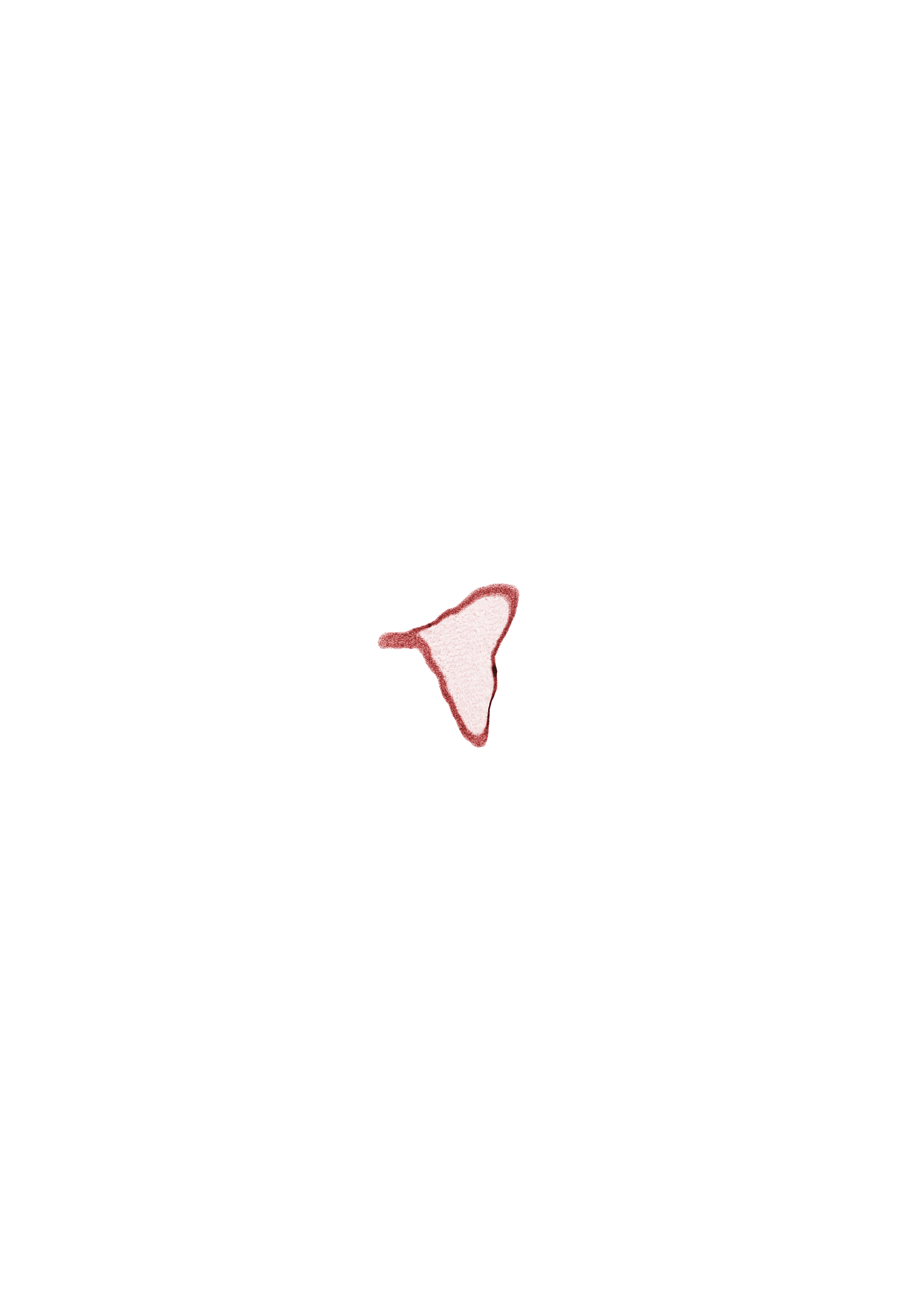 oblique section through surface ectoderm, subarachnoid space