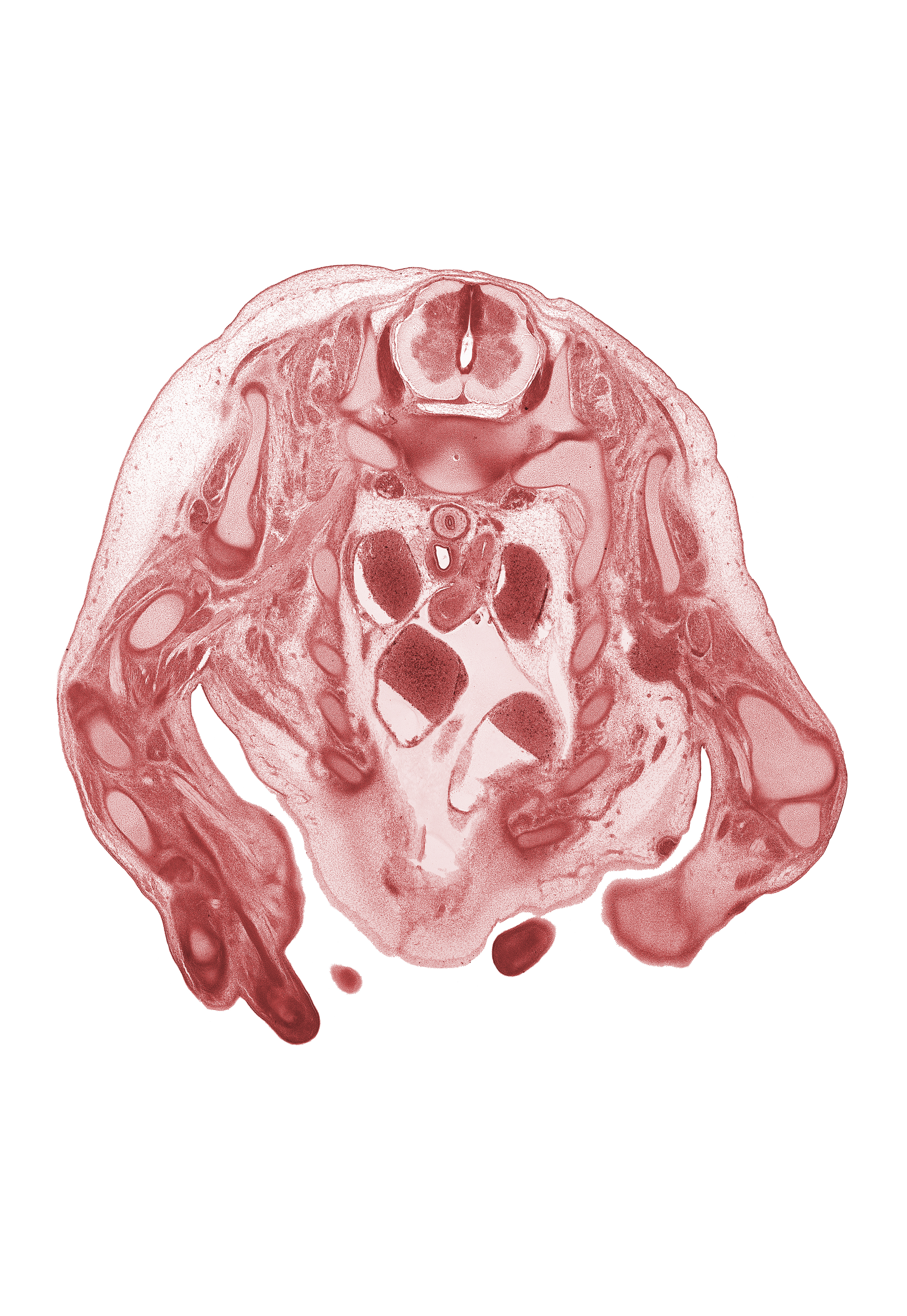 C-8 spinal ganglion, aorta, ascending aorta, blastemata of intercostal muscles, digit 2 (index finger), edge of hand, inferior cervical sympathetic ganglion, left atrium, pericardial cavity, right atrium, scapula, shaft of rib 1, shaft of rib 2, shaft of rib 4, subscapularis muscle, superior vena cava, supraspinatus muscle, teres major muscle, ulnar nerve