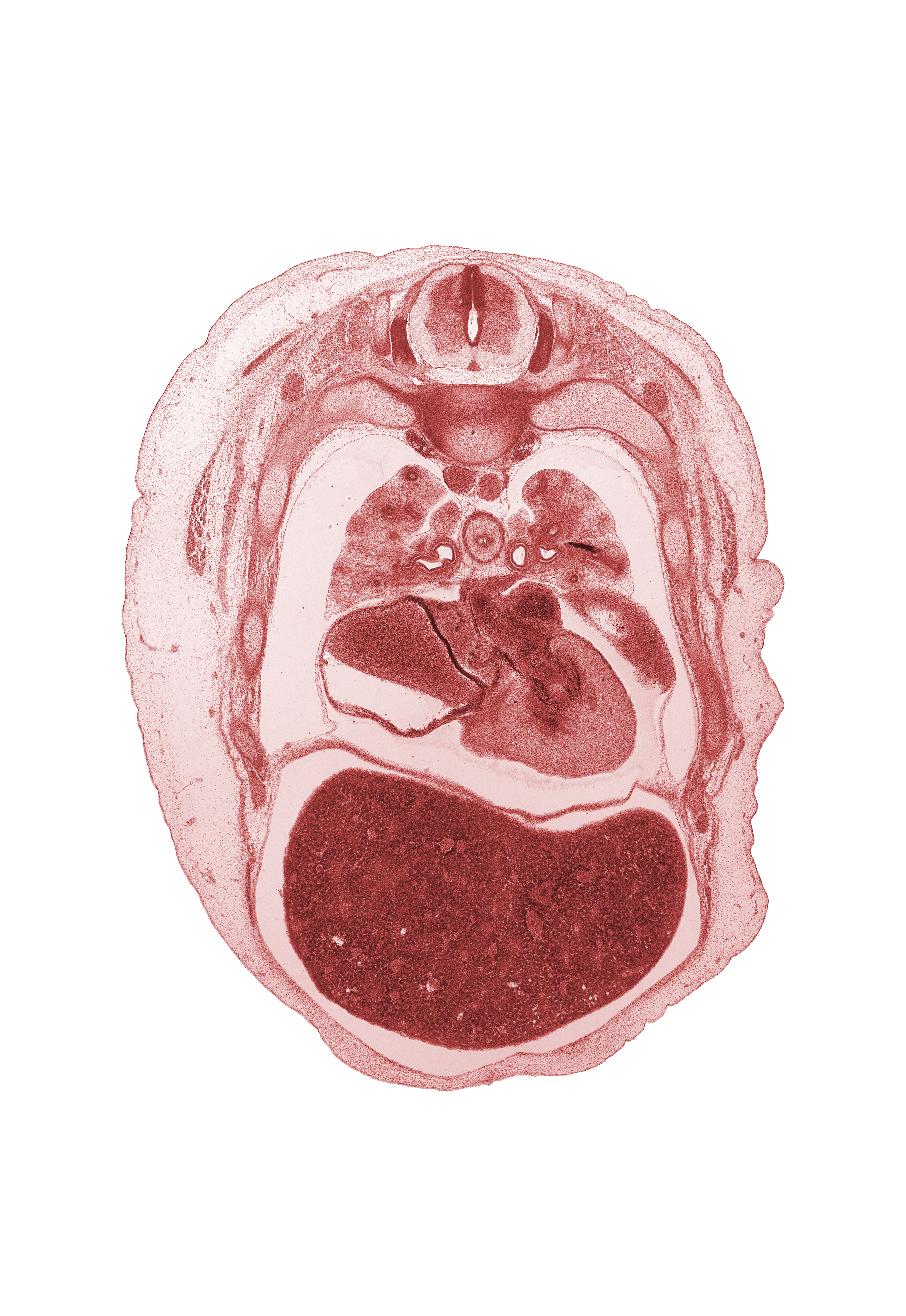 T-4 spinal ganglion, atrioventricular sulcus, azygos vein, central canal, central tendon of diaphragm, common pulmonary vein, esophageal nerve plexus, iliocostalis muscle, left atrioventricular canal, left atrium, left lobe of liver, left ventricle, longissimus muscle, lower secondary bronchus, middle secondary bronchus, neural arch, oblique fissure, papillary muscle, pericardial cavity, pericardial sac, primary interatrial septum (septum primum), rib 5, rib 6, secondary interatrial septum (septum secundum), spinalis muscle, sympathetic trunk, upper lobe of left lung