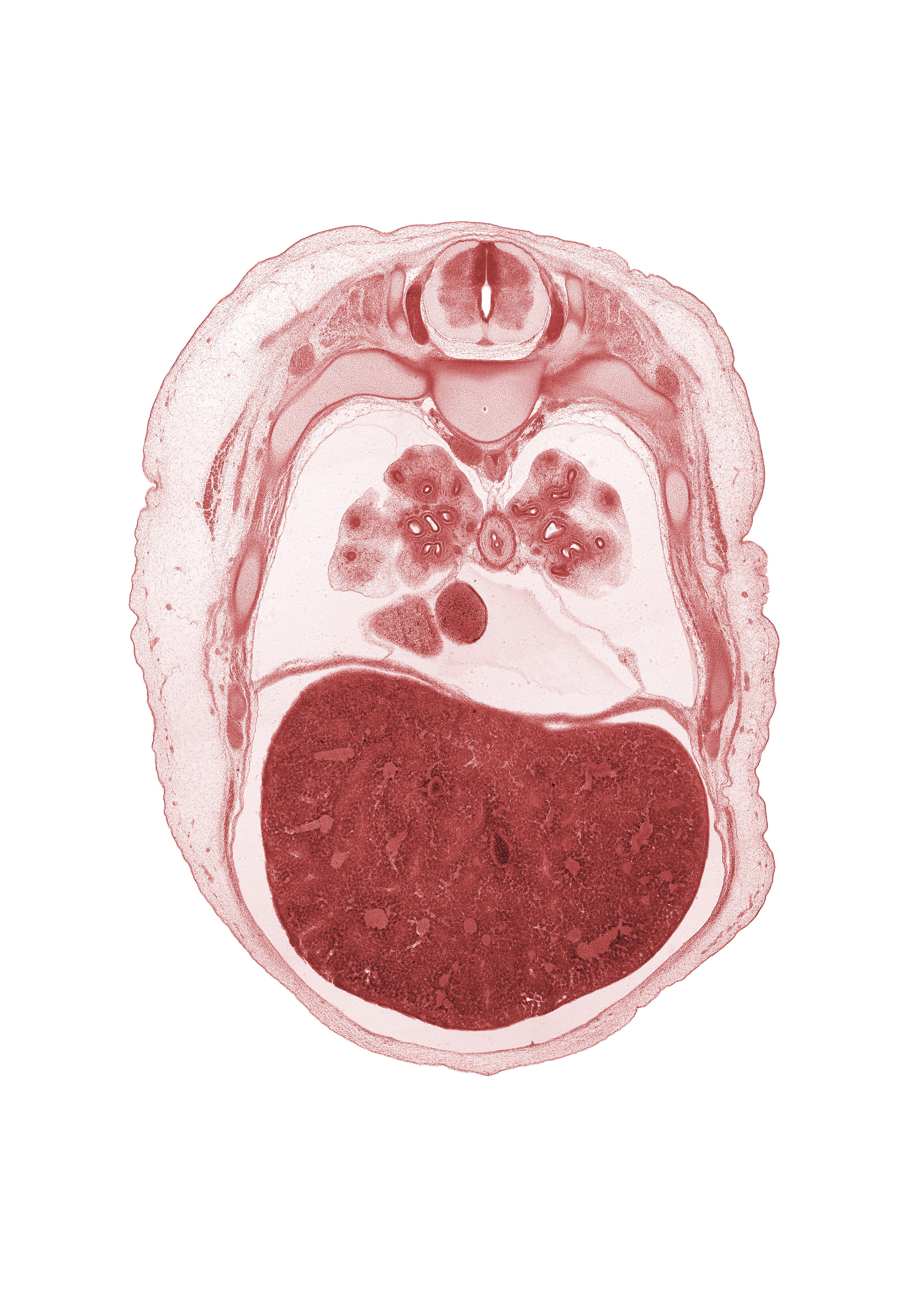 T-5 spinal ganglion, anterior basal segmental bronchus, aorta, azygos vein, diaphragm, dorsal horn of grey matter, edge of right atrium, external intercostal muscle(s), head of rib 6, inferior vena cava, lateral horn of grey matter, left lobe of liver, liver prominence, medial basal segmental bronchus, neural arch, oblique fissure, pericardial cavity, peritoneal cavity, rib 7, right lobe of liver, trapezius muscle, ventral horn of grey matter