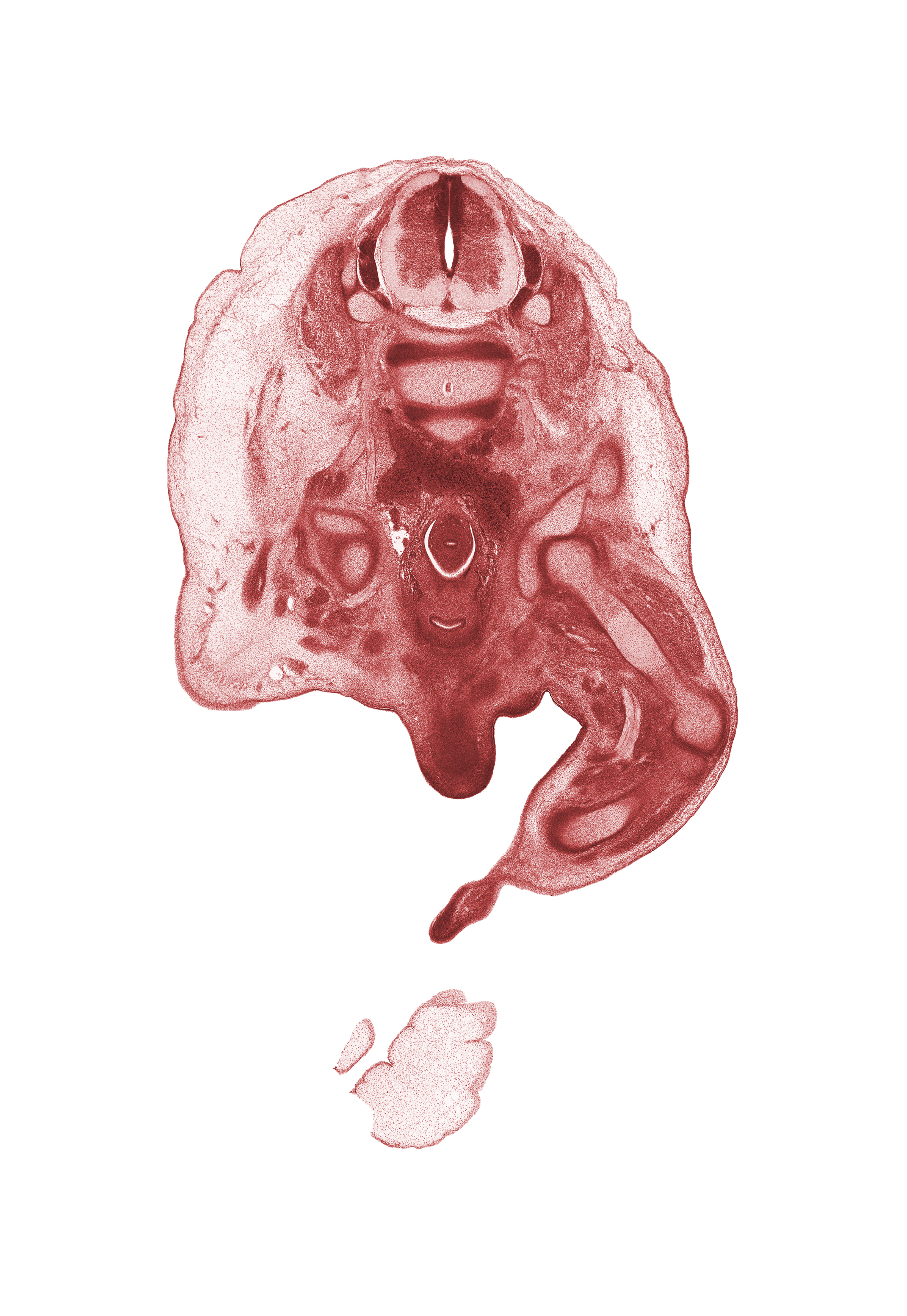 L-3 / L-4 intervertebral disc, L-3 spinal ganglion, L-3 spinal nerve, L-4 / L-5 intervertebral disc, L-4 spinal ganglion, distal end of femur, head of femur, hip joint, iliac crest, quadriceps femoris muscle, shaft of penis, sigmoid colon, tibia, tibial nerve, ureter, urinary bladder neck