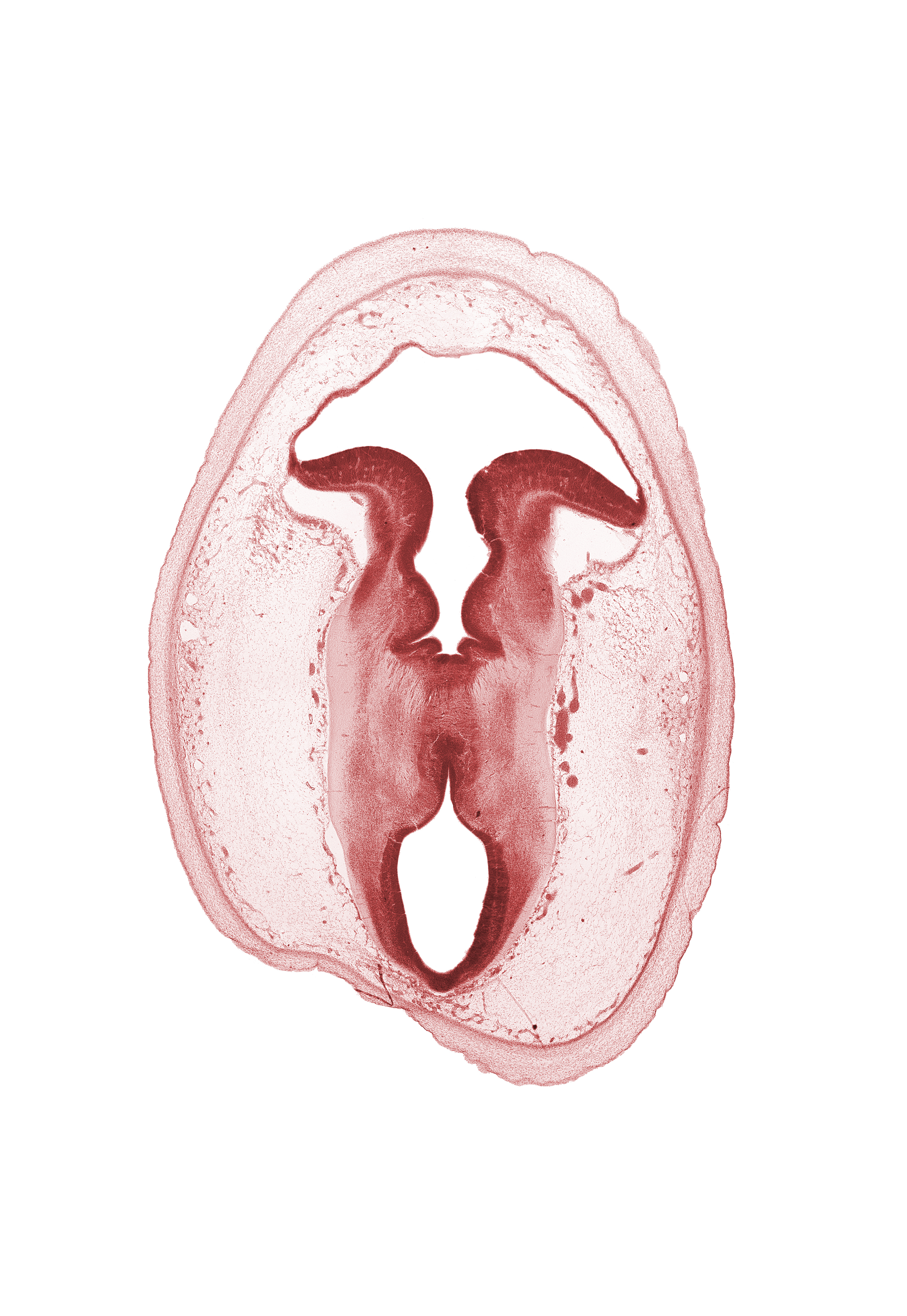 artifact separation(s), cerebral aqueduct (mesocoele), cerebral peduncle, isthmus of metencephalon, mesencephalon, osteogenic layer, rhombencoel (fourth ventricle), subarachnoid space, sulcus limitans, tectum, tegmentum, trochlear nerve (CN IV), vascular plexus