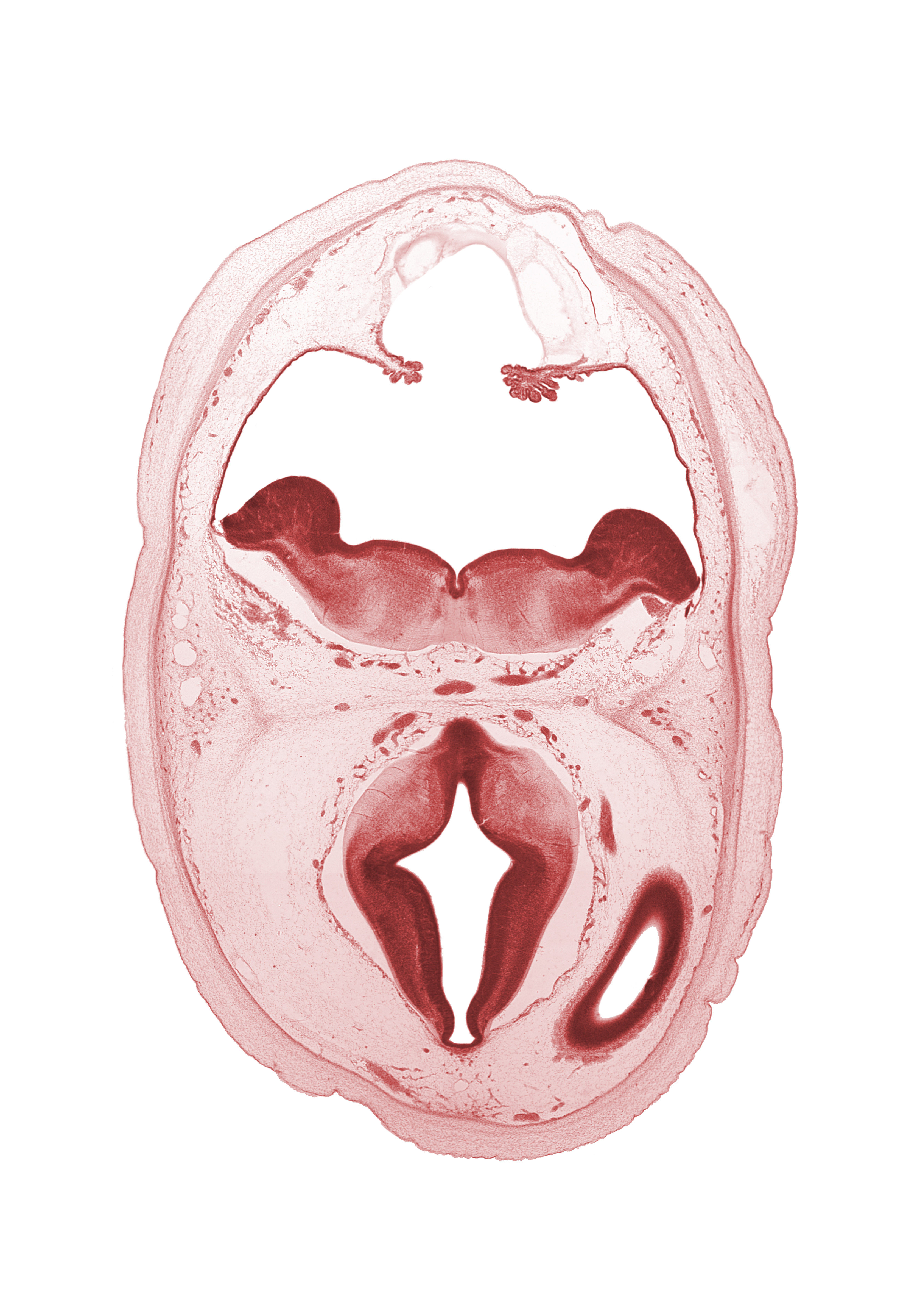 alar plate(s), basal plate, basilar artery, basis pedunculi of pons region (metencephalon), choroid plexus, diverticulum of rhombencoel (fourth ventricle), dorsal thalamus, external cerebellum, hypothalamic sulcus, intermediate zone of cerebral vesicle, internal cerebellum, lateral ventricle, median sulcus, osteogenic layer, posterior communicating artery, roof of rhombencoel (fourth ventricle), sulcus dorsalis, sulcus limitans, tegmentum of pons, third ventricle