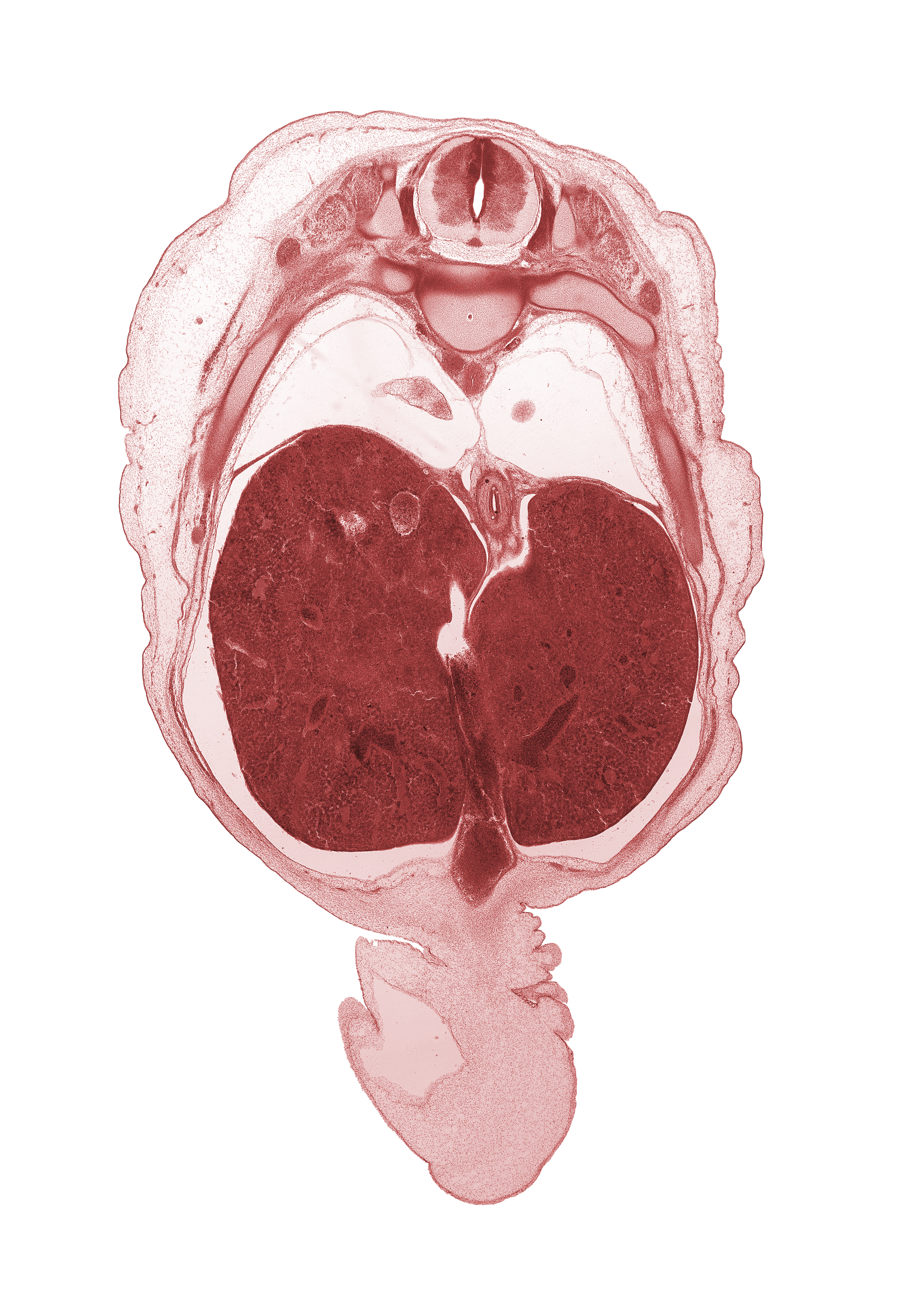 T-9 dorsal root, T-9 spinal ganglion, T-9 spinal nerve, T-9 ventral root, caudal edge of left lung, dorsal horn of grey matter, head of rib 9, inferior vena cava (hepatic part), junction of ductus venosus and hepatic portal vein, junction of ductus venosus and umbilical vein, lateral horn of grey matter, latissimus dorsi muscle, liver prominence, lower lobe of right lung, peritoneal cavity, pleural cavity, rib 10, umbilical coelom, umbilical cord, umbilical vein, ventral horn of grey matter