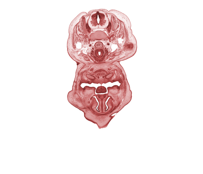 C-6 spinal ganglion, anterior belly of digastric muscle, central canal, cricoid cartilage, dorsal fasciculus, dorsum of tongue, esophagus endoderm, frenulum of tongue, inferior meatus, inferior nasal concha, internal carotid artery, internal jugular vein, jugular lymph sac, middle cervical sympathetic ganglion, mylohyoid muscle, nasal capsule cartilage condensation, nasal septal cartilage, nasolacrimal duct, neural arch, oral cavity, pharyngeal arch 1 cartilage (Meckel), superior parathyroid gland, thyroid gland, trapezius muscle