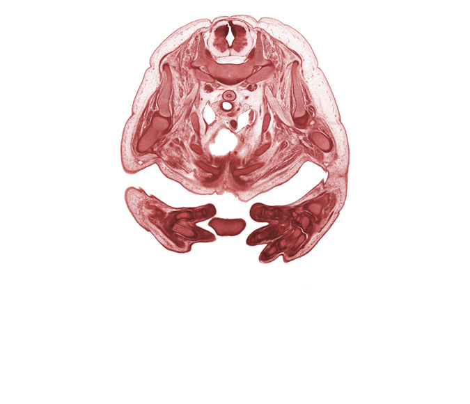 T-2 / T-3 interganglion region, ascending aorta, auricle of left atrium, auricle of right atrium, central canal, heart prominence, interventricular sulcus, left hand, left vagus nerve (CN X), left ventricle, neural arch, rib 3, rib 4, rib 5, rib 6, rib 7, right pulmonary artery, right vagus nerve (CN X), sulcus limitans, trabecular part of right ventricle, tracheal bifurcation, ulna, upper lobe of left lung