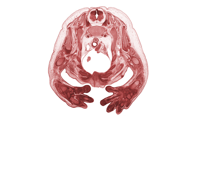 T-1 intercostal nerve, T-1 spinal ganglion, arch of aorta, artifact fracture(s), biceps brachii muscle, central canal, cephalic edge of right atrium, cephalic edge of right pleural cavity, inferior cervical sympathetic ganglion, left pleural cavity, left subclavian artery, metacarpal 3, osteogenic layer, pericardial cavity, radius, rhomboid minor muscle, rib 1, rib 2, rib 3, rib 4, superior vena cava, trachea, trapezius muscle