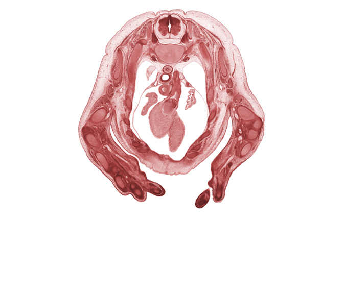 T-2 spinal ganglion, T-2 spinal nerve, auricle of left atrium, auricle of right atrium, cephalic edge of left ventricle, ductus arteriosus, heart prominence, interventricular sulcus, metacarpal 4, neural arch, notochord, osteogenic layer, pleural cavity, pulmonary semilunar valve, pulmonary trunk, right ventricle, scapula, sympathetic trunk, triceps brachii muscle, ulna