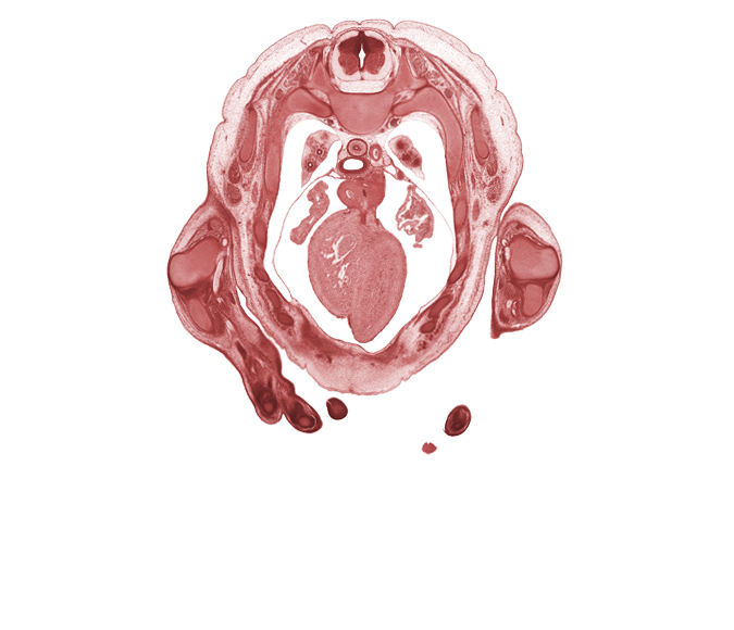 T-2 / T-3 interganglion region, ascending aorta, auricle of left atrium, auricle of right atrium, central canal, heart prominence, interventricular sulcus, left vagus nerve (CN X), left ventricle, neural arch, rib 3, rib 4, rib 5, rib 6, rib 7, right pulmonary artery, right vagus nerve (CN X), sulcus limitans, trabecular part of right ventricle, tracheal bifurcation, ulna, upper lobe of left lung