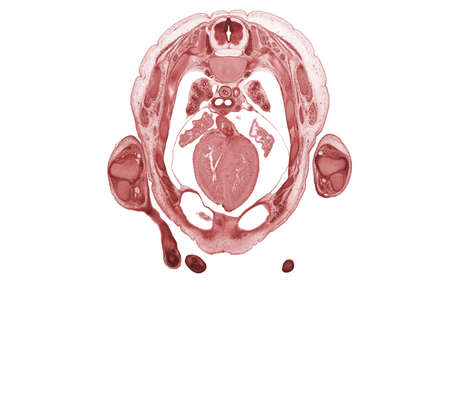 T-3 intercostal nerve, T-3 spinal ganglion, aortic semilunar valve, auricle of left atrium, auricle of right atrium, caudal edge of hand, central tendon of diaphragm, interventricular sulcus, lateral epicondyle of humerus, left primary bronchus, left ventricle, muscular part of interventricular septum, peritoneal cavity, pleural cavity, rib 4, right primary bronchus, right ventricle, scapula, transverse pericardial sinus, ulna, upper lobe of left lung, upper lobe of right lung