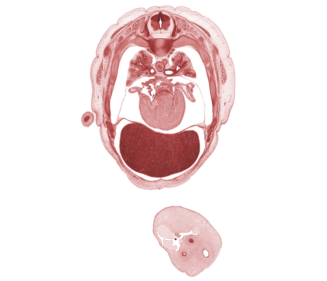 T-4 spinal ganglion, allantois, amnion on surface of umbilical cord, aorta, artifact disruption of amnion, caudal edge of elbow, latissimus dorsi muscle, left atrioventricular canal, left atrium, left lobe of liver, left umbilical artery, left ventricle, liver prominence, mucoid connective tissue, rib 5, rib 6, rib 7, right atrioventricular canal, right lobe of liver, right umbilical artery, right ventricle, scapula, umbilical coelom, umbilical vein, upper lobe of left lung, upper lobe of right lung