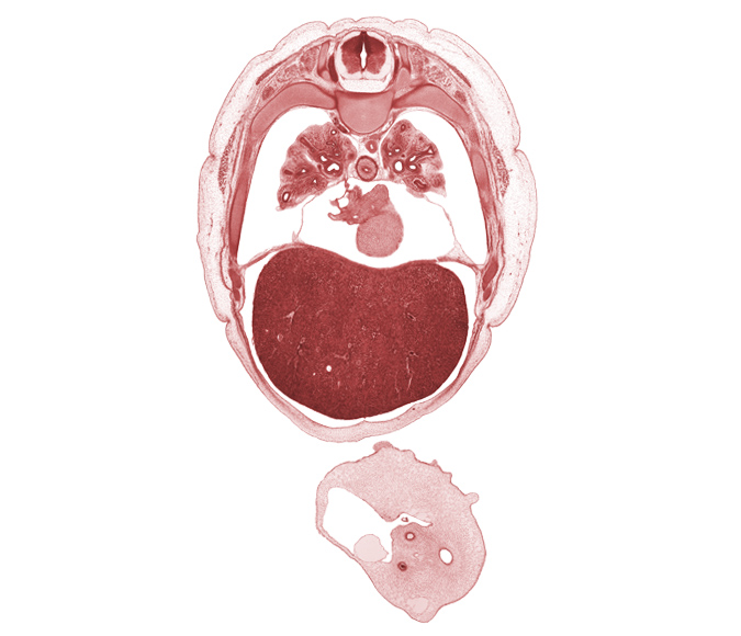 T-5 spinal ganglion, aorta, left ventricle, lingula of upper lobe of left lung, lower lobe of left lung, lower lobe of right lung, lower secondary bronchus, middle lobe of right lung, oblique fissure, pericardial cavity, peritoneal cavity, rib 6, rib 7, rib 8, rib 9, right atrium, umbilical coelom, umbilical vesicle stalk