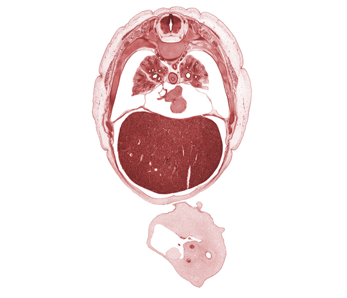 L-5 ventral primary ramus, T-5 / T-6 interganglion region, T-6 intercostal nerve, allantois, caudal edge of lingula of upper lobe of left lung, external abdominal oblique muscle, inferior vena cava, left umbilical artery, left ventricle, liver prominence, lower lobe of right lung, middle lobe of right lung, oblique fissure, peritoneal cavity, rib 7, rib 8, rib 9, right atrium, right lower pulmonary vein, right umbilical artery, sympathetic trunk, umbilical coelom, umbilical vein