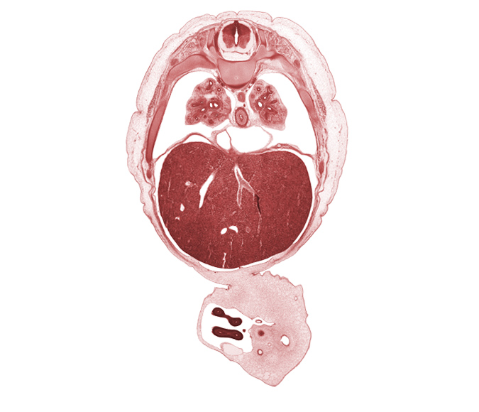 T-6 / T-7 interganglion region, aorta, artifact fracture(s), cyst, distal limb of herniated midgut, external abdominal oblique muscle, inferior vena cava, lower lobe of right lung, notochord, pericardial cavity, pericardial sac, proximal limb of herniated midgut, rib 8, rib 9, sympathetic trunk, umbilical cord