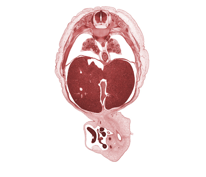 T-7 / T-8 interganglion region, afferent hepatic vein, aorta, central canal, diaphragm, distal limb of herniated midgut, ductus venosus, esophagus, left lobe of liver, lower lobe of left lung, lower lobe of right lung, neural arch, pleural recess, proximal limb of herniated midgut, rib 9, right lobe of liver, sympathetic trunk, umbilical vesicle stalk