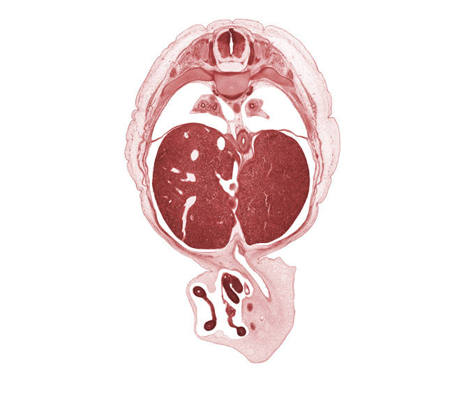 T-8 spinal ganglion, afferent hepatic vein, aorta, distal limb of herniated midgut, esophagus lumen, iliocostalis muscle, left lobe of liver, longissimus muscle, lower lobe of left lung, lower lobe of right lung, proximal limb of herniated midgut, pylorus of stomach, rib 9, right lobe of liver, spinalis muscle, umbilical vein, umbilical vesicle stalk