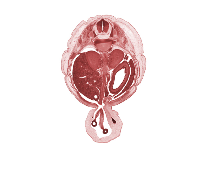 T-11 / T-12 intervertebral disc, T-11 spinal ganglion, T-11 spinal nerve, aorta, cephalic edge of ovary, duodenum (second part), head of ventral pancreas, junction of hindgut and midgut, left lobe of liver, mesonephros, proximal limb of herniated midgut, right lobe of liver, superior mesenteric artery, suprarenal gland cortex, sympathetic trunk, umbilical coelom