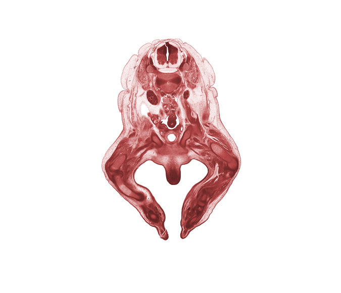 L-2 spinal ganglion, L-2 spinal nerve, artifact fracture(s), external abdominal oblique muscle, femoral nerve, femur, glans clitoris, hindgut, inferior pole of kidney (metanephros), internal abdominal oblique muscle, junction of internal iliac and umbilical arteries, labial swelling (labium major), lateral plantar nerve, medial plantar nerve, obturator nerve, paramesonephric duct, plantar surface of foot, psoas major muscle, pubis, sciatic nerve, tibia, tibial nerve, transversus abdominis muscle, ureter, urinary bladder