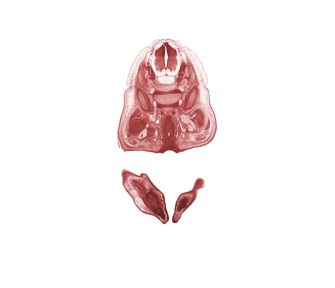 L-4 spinal ganglion, L-5 spinal ganglion, ala of sacrum, anal fold, anal pit, anterior spinal artery, dorsal horn of grey matter, gluteus medius muscle, gluteus minimus muscle, pudendal nerve, rectum, right foot, superior gluteal nerve, sympathetic trunk, ventral horn of grey matter