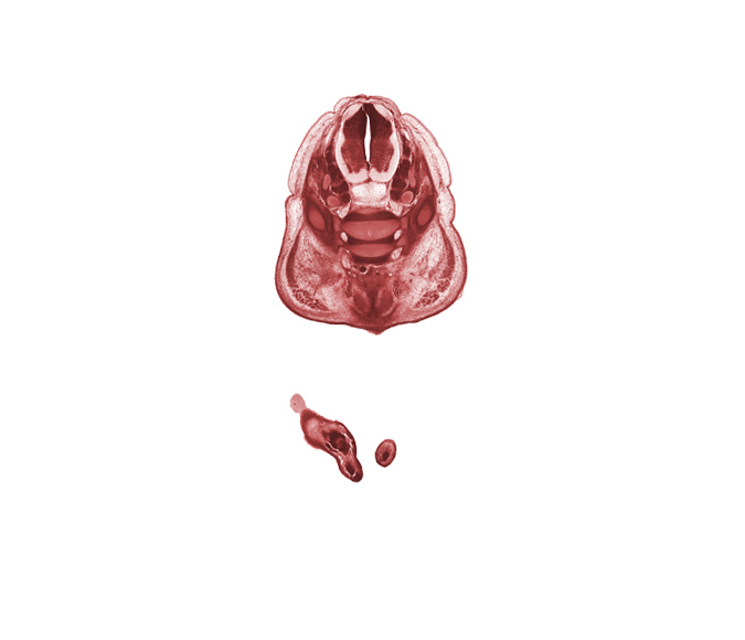 L-4 spinal ganglion, L-5 spinal ganglion, L-5 spinal nerve, S-1 / S-2 intervertebral region, S-1 ventral primary ramus, caudal eminence, dorsal fasciculus, gluteus maximus muscle, left foot, levator ani muscle, right foot, subarachnoid space, sympathetic trunk