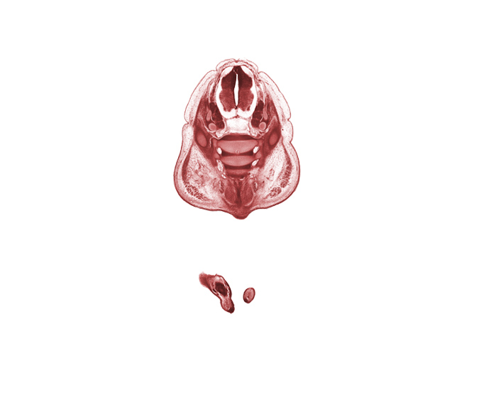 L-4 spinal ganglion, L-5 spinal ganglion, ala of sacrum, caudal edge of left foot, caudal eminence, dorsum of right foot, edge of ilium, gluteus maximus muscle, ischiorectal fossa, levator ani muscle, neural arch of L-5 vertebra, notochord, subarachnoid space