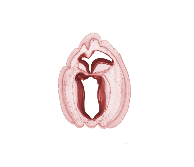 alar plate of mesencephalon, alar plate of metencephalon, fiber tract, intermediate zone, marginal zone, rhombencoel (fourth ventricle), roof plate, roof plate of metencephalon, root of trochlear nerve (CN IV), ventricular zone