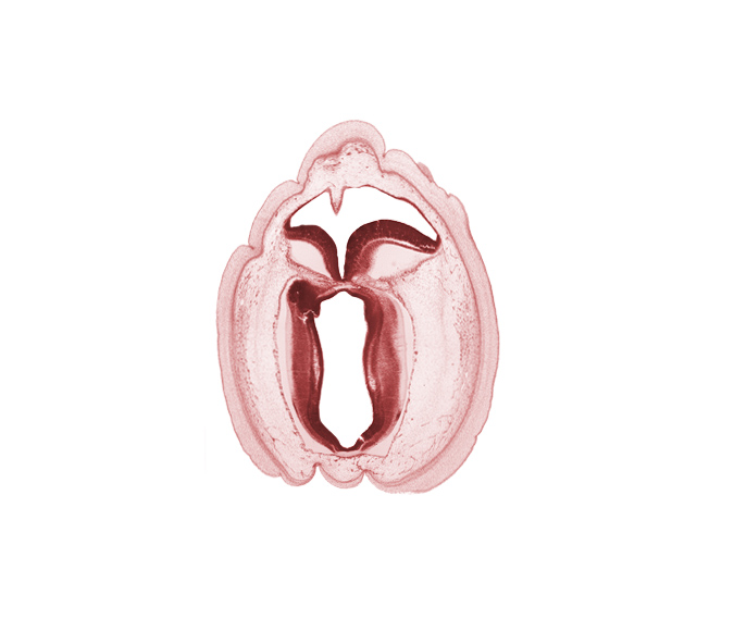 artifact space(s), cerebral aqueduct (longitudinal section), commissure in roof plate of mesencephalon, fiber tract, head mesenchyme, osteogenic layer, rhombencoel (fourth ventricle), subarachnoid space, surface ectoderm, trochlear nerve (CN IV)