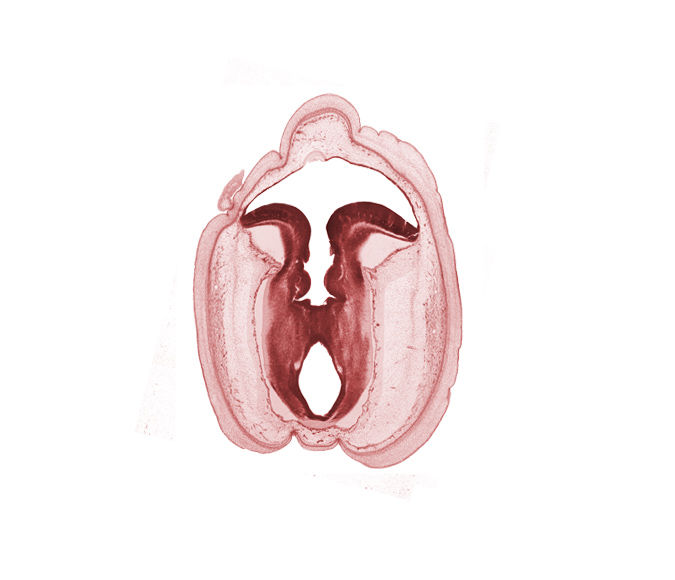 artifact space(s), cerebral aqueduct (mesocoele), commissure in roof plate of mesencephalon, fiber tract, floor plate of mesencephalon, head mesenchyme, osteogenic layer, rhombencoel (fourth ventricle), roof plate of metencephalon, subarachnoid space, sulcus limitans, surface ectoderm, vascular plexus