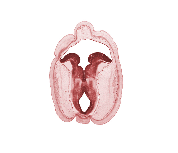 artifact space(s), cerebral aqueduct (mesocoele), head mesenchyme, mesencephalon, osteogenic layer, rhombencoel (fourth ventricle), subarachnoid space, surface ectoderm, tectum of mesencephalon, trochlear nerve (CN IV), vascular plexus