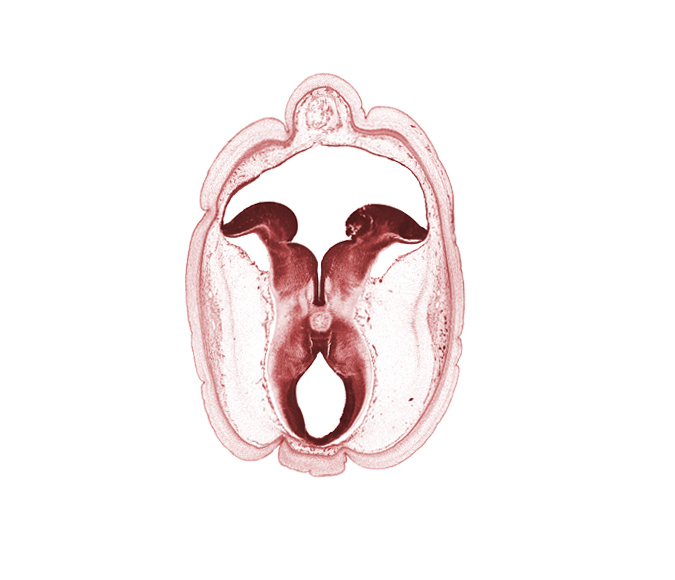 cerebral aqueduct (mesocoele), cerebral peduncle, diverticulum of rhombencoel (fourth ventricle), interpeduncular fossa, mesencephalon, metencephalon, osteogenic layer, rhombencoel (fourth ventricle), roof plate, subarachnoid space, sulcus limitans, tectum of mesencephalon, tegmentum of mesencephalon, tegmentum of metencephalon, trochlear nerve (CN IV)