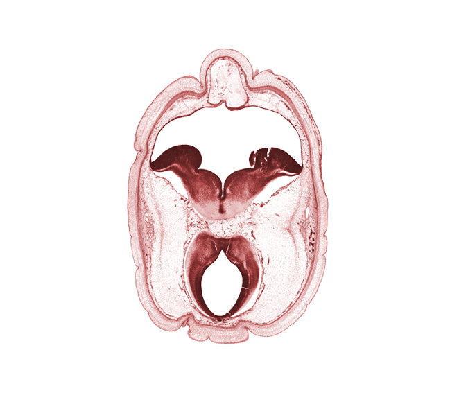 artifact fracture(s), artifact space(s), cephalic part of dural band for tentorium cerebelli, cerebral aqueduct (mesocoele), osteogenic layer, pons region (metencephalon), region of mesencephalic (cephalic) flexure, rhombencoel (fourth ventricle), root of oculomotor nerve (CN III), subarachnoid space, superficial vascular plexus