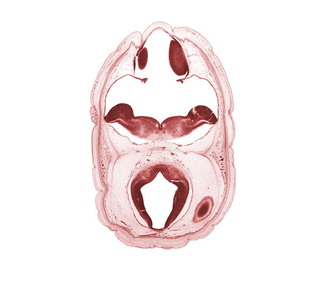 alar plate of myelencephalon, artifact space(s), cerebral aqueduct (mesocoele), cerebral vesicle (hemisphere), choroid plexus, dural band for tentorium cerebelli, median sulcus, posterior cerebral artery, rhombencoel (fourth ventricle), roof plate, roof plate of mesencephalon, sulcus limitans, tectum of mesencephalon, tegmentum of mesencephalon, trochlear nerve (CN IV)