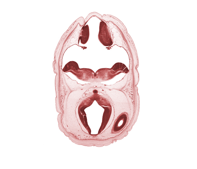 alar plate of metencephalon (cerebellum), artifact space(s), basal plate of caudal part of diencephalon, basal plate of metencephalon, caudal edge of diencephalon, cerebral aqueduct (mesocoele), edge of lateral ventricle, myelencephalon, osteogenic layer, rhombencoel (fourth ventricle), roof plate of mesencephalon, subarachnoid space, trochlear nerve (CN IV)