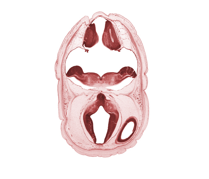 alar plate of myelencephalon, alar plate(s), artifact space(s), basilar artery, cerebral vesicle (hemisphere), choroid plexus, fiber tract, hypothalamic sulcus, hypothalamus, lateral ventricle, oculomotor nerve (CN III), osteogenic layer, posterior communicating artery, rhombencoel (fourth ventricle), roof plate, roof plate of diencephalon, roof plate of myelencephalon, trochlear nerve (CN IV), ventral thalamus