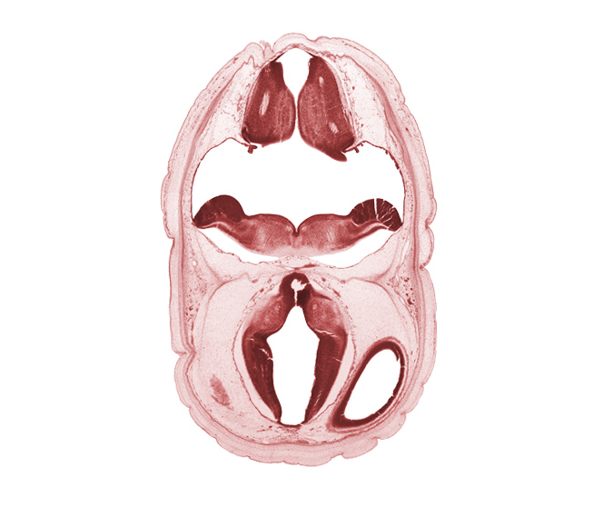 alar plate of myelencephalon, artifact fracture(s), artifact space(s), dorsal thalamus, dural band for tentorium cerebelli, edge of cerebral vesicle (hemisphere), fiber tract, hypothalamic sulcus, lateral ventricle, median sulcus, oculomotor nerve (CN III), osteogenic layer, subarachnoid space, superficial vascular plexus, surface ectoderm, third ventricle