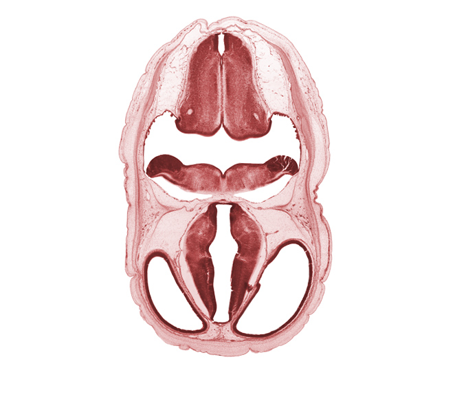 alar plate(s), artifact fracture(s), artifact space(s), basal plate, decussation in floor plate, hypothalamic sulcus, lateral ventricle, obex, posterior communicating artery, rhombencoel (fourth ventricle), sulcus dorsalis, sulcus limitans, third ventricle, venous plexus(es)