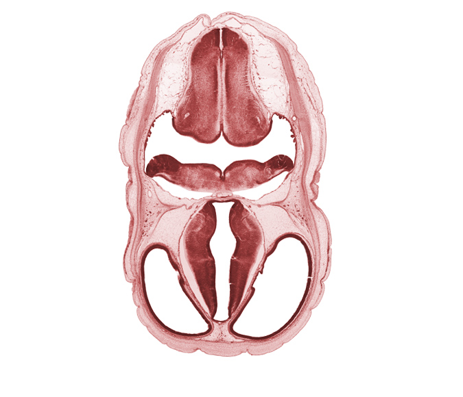 artifact space(s), decussation in floor plate of myelencephalon, dorsal thalamus, dural band for tentorium cerebelli, endolymphatic sac, fiber tract, hypothalamus, rhombencoel (fourth ventricle), roof plate of diencephalon, root of vagus nerve (CN X), stem of posterior dural venous plexus, venous plexus(es), ventral thalamus, zona limitans intrathalamica