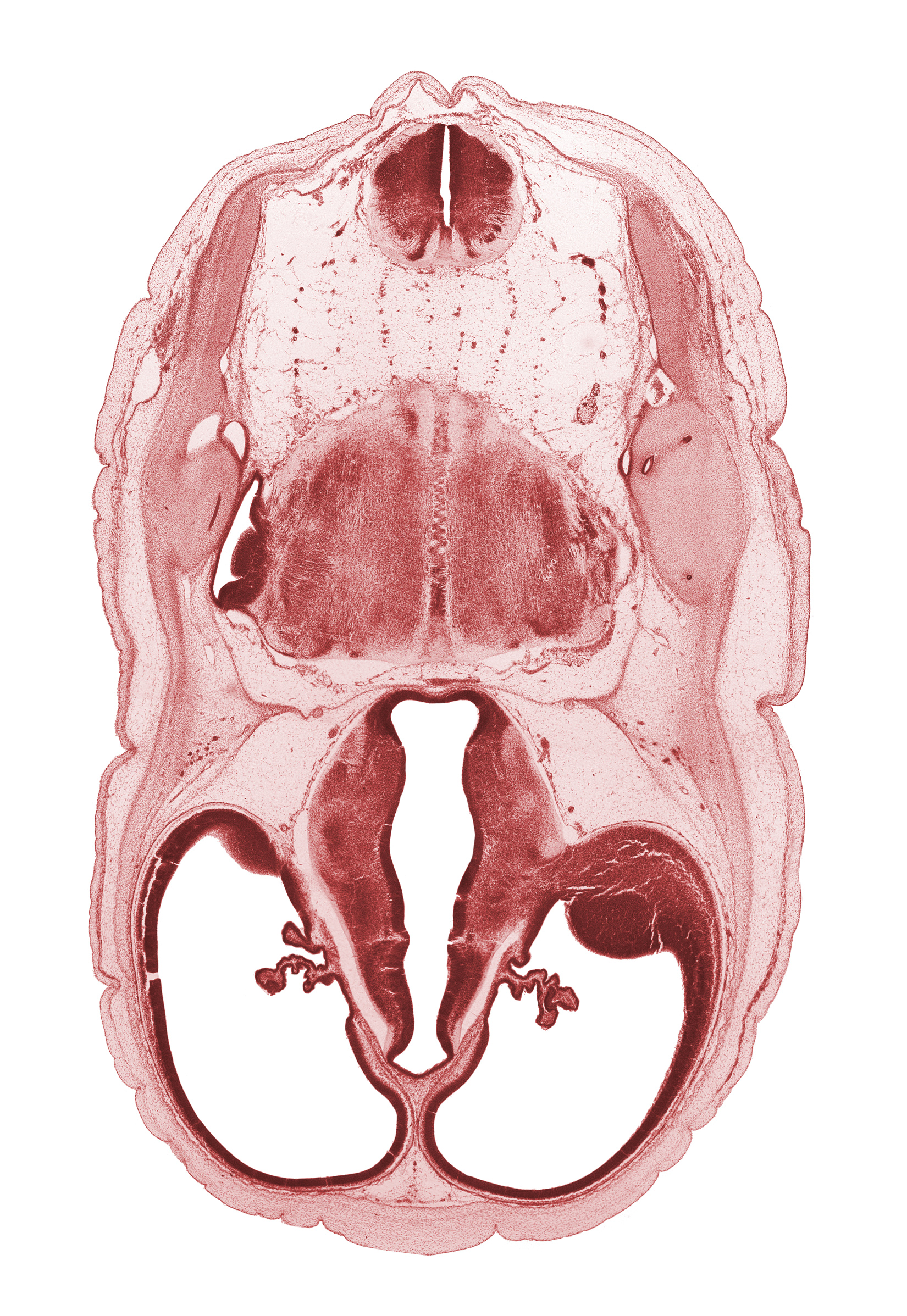 artifact fracture(s), basilar artery, cerebral vesicle (hemisphere), common crus, edge of anterior semicircular duct, endolymphatic duct, exoccipital, floor plate of diencephalon, glossopharyngeal nerve (CN IX), hypothalamus, lateral recess of rhombencoel (fourth ventricle), lateral semicircular duct, lateral ventricle, lateral ventricular eminence (telencephalon), oculomotor nerve (CN III), posterior communicating artery, posterior semicircular duct, roof plate of diencephalon, root of hypoglossal nerve (CN XII), root of vagus nerve (CN X), third ventricle, trochlear nerve (CN IV)