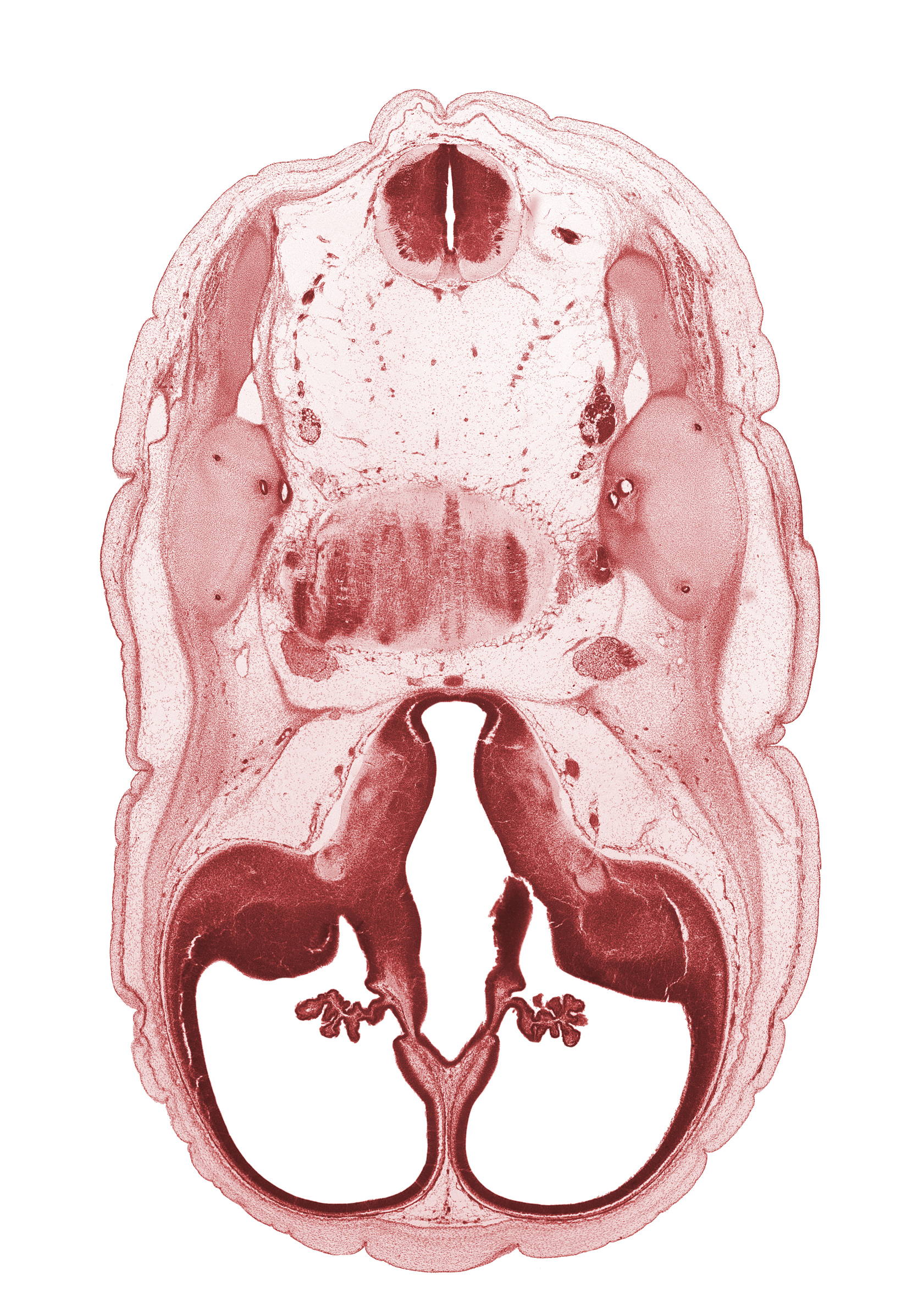 accessory nerve (CN XI), anterior semicircular duct, basilar artery, cerebral vesicle (hemisphere), common crus, edge of interventricular foramen, facial nerve (CN VII), glossopharyngeal nerve (CN IX), lateral ventricle, lateral ventricular eminence (telencephalon), posterior communicating artery, posterior semicircular duct, third ventricle, vagus nerve (CN X), vestibulocochlear nerve (CN VIII)