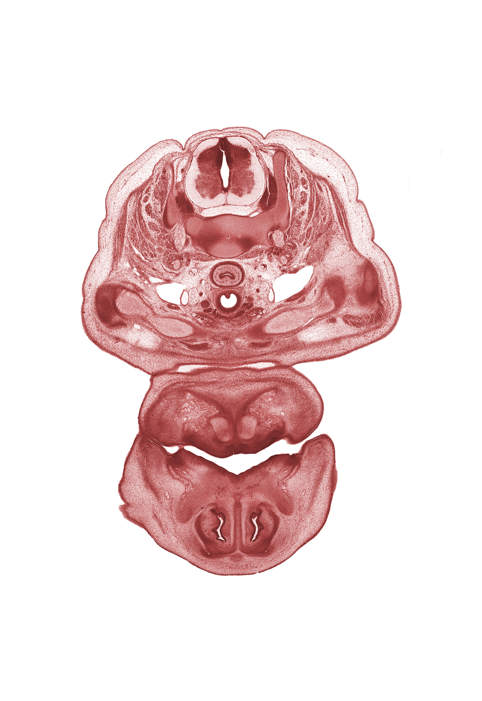 C-5 / C-6 intervertebral disc, C-6 spinal nerve, C-7 spinal ganglion, central canal, clavicle, esophagus, inferior parathyroid gland, intermediate zone, internal jugular vein, isthmus of thyroid gland, marginal zone, nasal capsule cartilage condensation, nasal cavity (nasal sac), nasal septal cartilage, oral cavity, oral fissure, pharyngeal arch 1 cartilage (Meckel), primary palate, vagus nerve (CN X), ventricular zone