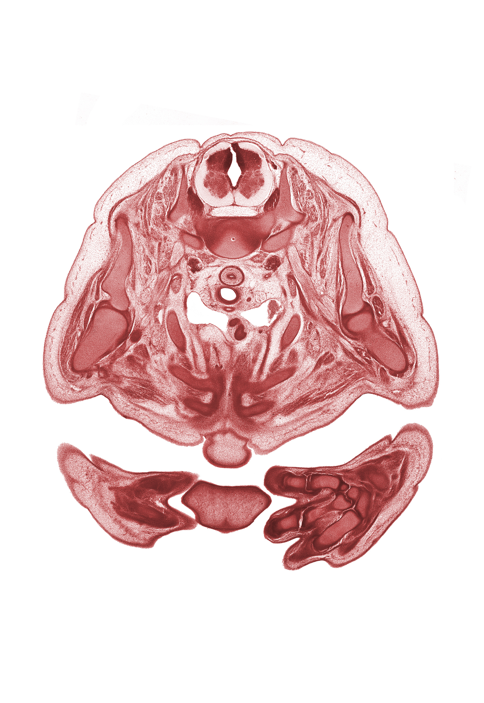 C-6 / C-7 intervertebral disc, T-12 spinal ganglion, alar plate(s), basal plate, brachiocephalic artery, edge of chin, floor plate, head of humerus, head of rib 1, hemisternum, left common carotid artery, left subclavian artery, metacarpal 3, metacarpophalangeal joint, neural arch, nose, notochord, pectoralis major muscle, pectoralis minor muscle, rib 2, rib 3, roof plate, sulcus limitans, superior vena cava, thymus gland, transverse process