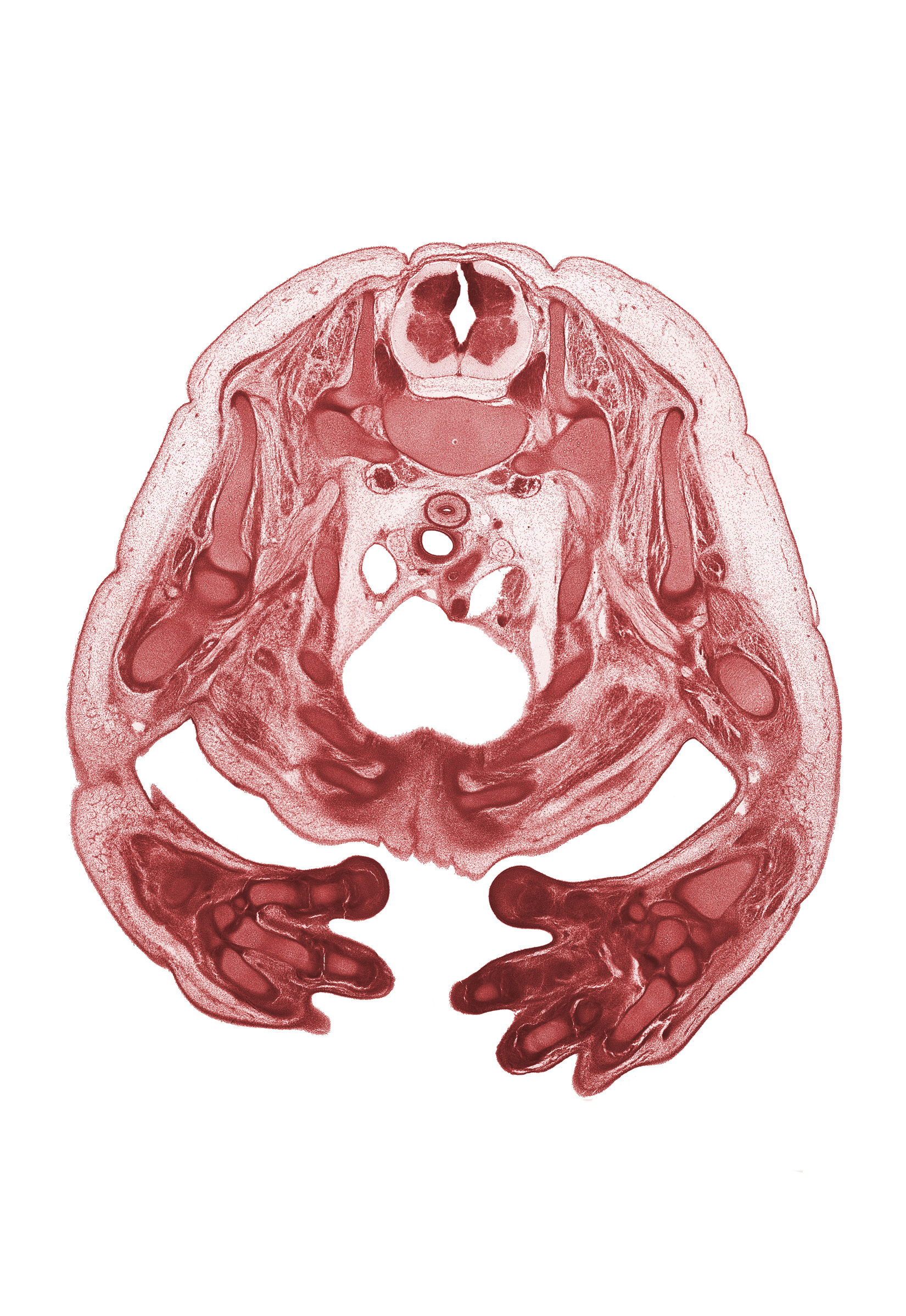 T-1 intercostal nerve, T-1 spinal ganglion, T-1 spinal nerve, brachial artery, brachial plexus, caudal edge of thymus gland, cephalic edge of left pleural cavity, esophagus muscularis, hemisternum, left digit 1 (thumb), lunate, median nerve, metacarpal 2, metacarpal 4, notochord, pericardial cavity, radius, rib 1, rib 2, rib 3, rib 4, rib 5, scapula, subarachnoid space, superior vena cava, trachea