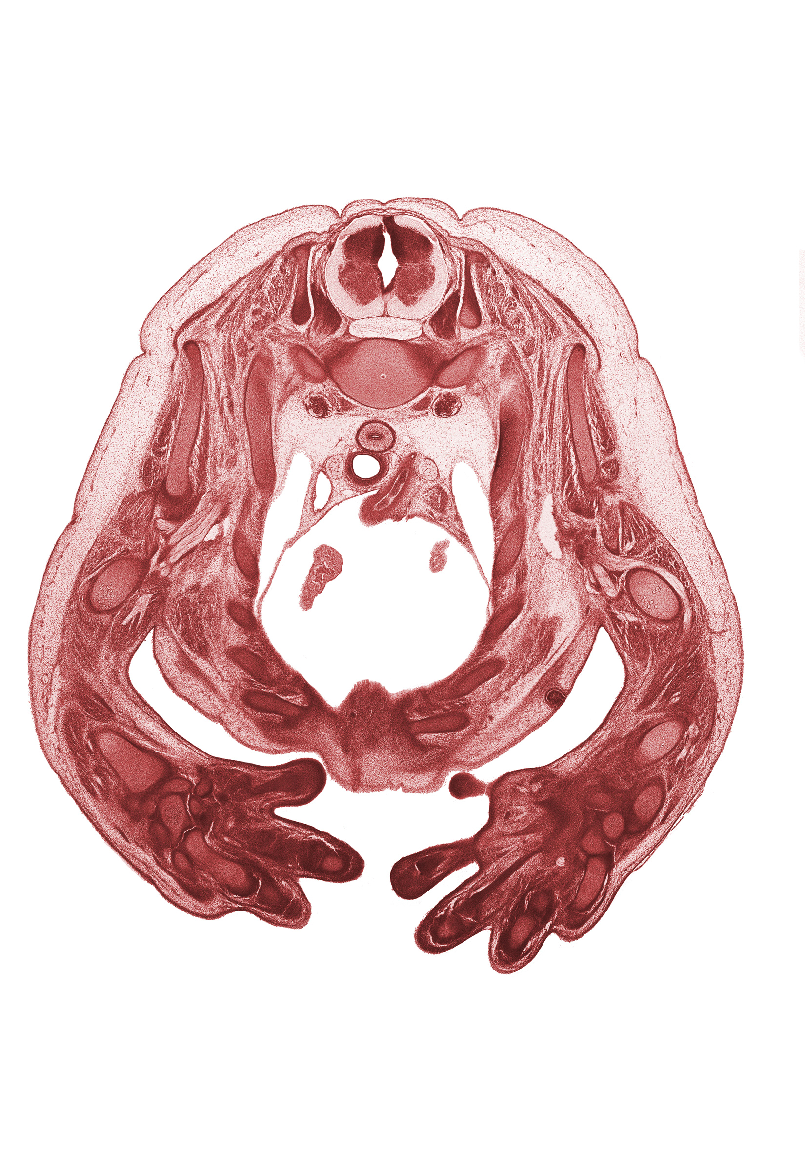 T-1 spinal ganglion, arch of aorta, auricle of right atrium, axillary nerve, brachioradialis muscle, cephalic edge of auricle of left atrium, esophagus endoderm, grey matter, hamate, head of rib 2, hemisternum, inferior cervical sympathetic ganglion, metacarpal 3, metacarpal 5, middle phalynx of digit 4 (ring finger), pericardial cavity, radius, rib 2, rib 3, rib 4, rib 5, superior vena cava, ulna, white matter