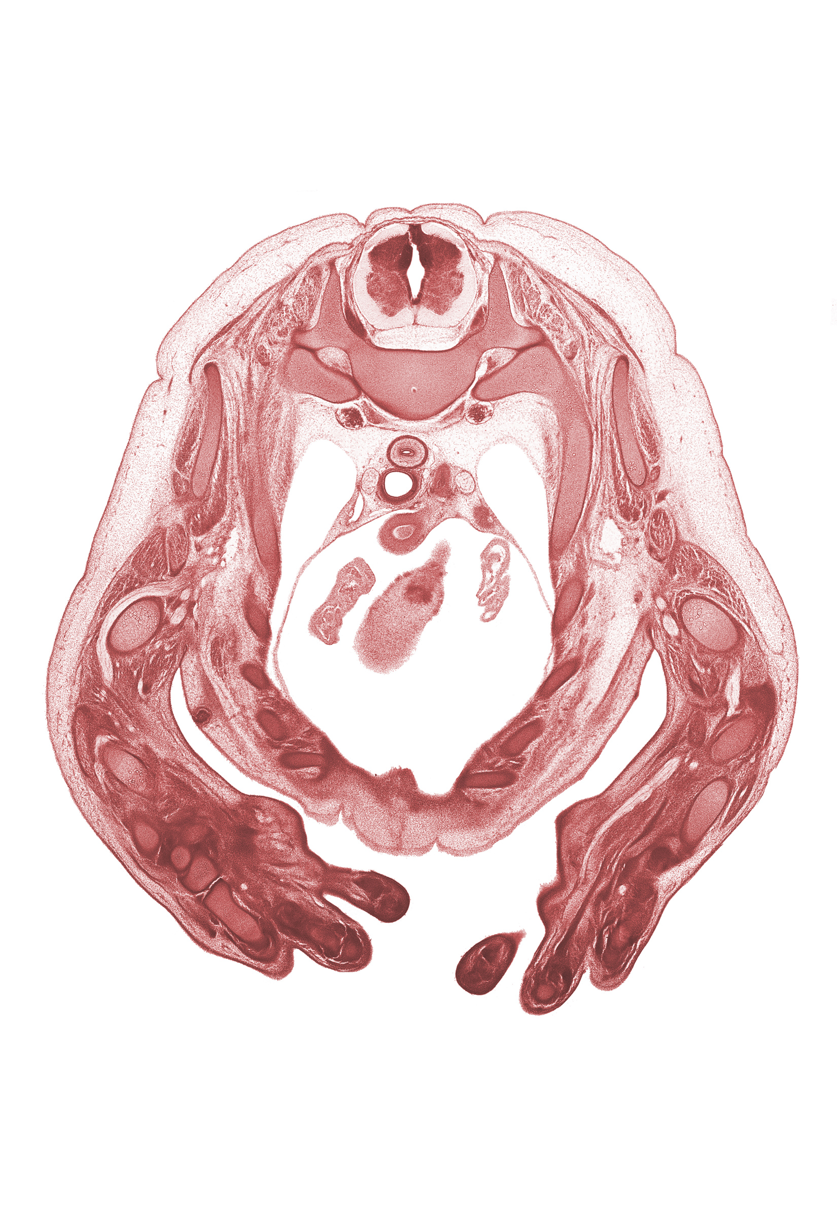 T-1 / T-2 interganglion region, aorta, ascending aorta, auricle of left atrium, auricle of right atrium, capitate, central canal, digit 5 (little finger), esophagus, head of ulna, hemisternum, humerus, metacarpal 4, neural arch, radial nerve, radius, rib 2, rib 3, rib 4, rib 5, right ventricle, superior vena cava, sympathetic trunk, trachea, vagus nerve (CN X)