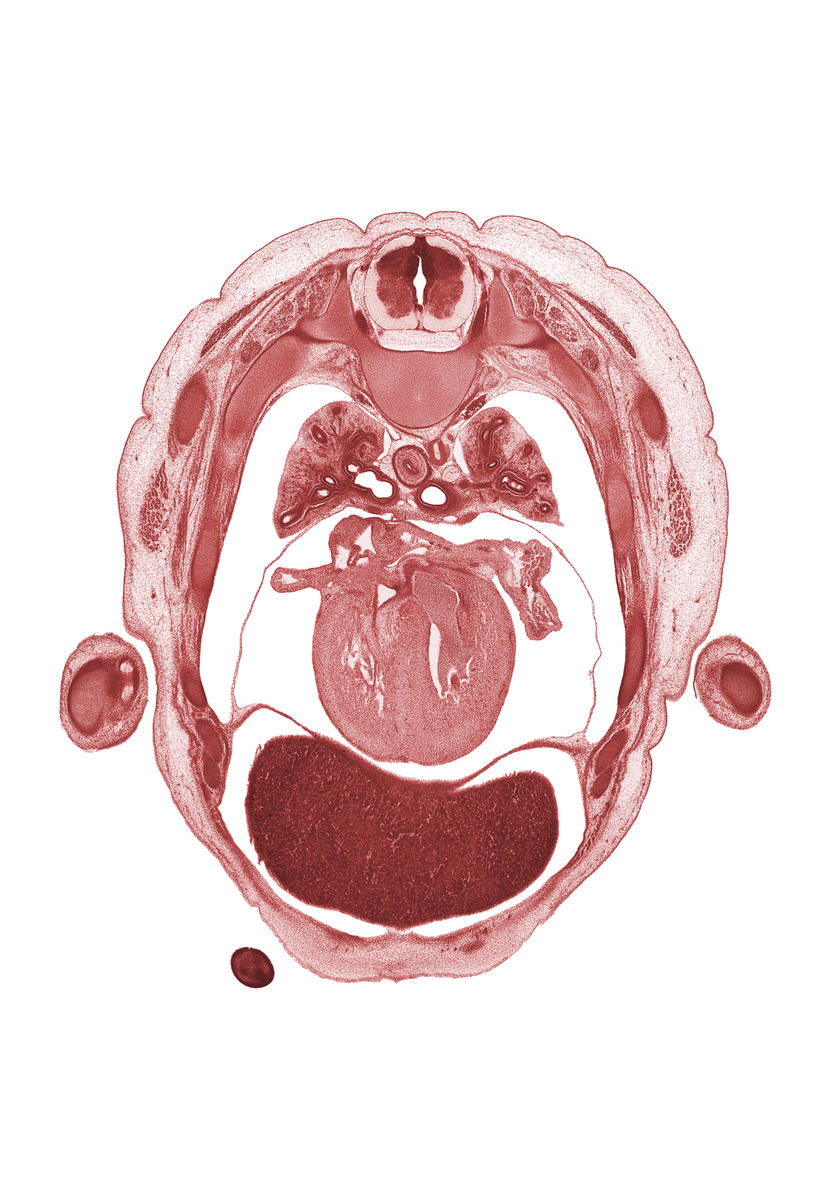 T-4 intercostal nerve, T-4 spinal ganglion, aortic vestibule, auricle of left atrium, azygos vein, digits (fingers), left lobe of liver, left vagus nerve (CN X), pericardial sac, peritoneal cavity, primary bronchus, pulmogenic coat, rhomboid major muscle, right lobe of liver, right vagus nerve (CN X), sinus venosus, trapezius muscle, ulnar nerve, upper lobe of right lung, upper secondary bronchus